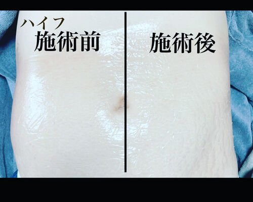 E83B4A77-5D45-474B-B084-7ABE89C3A8B0