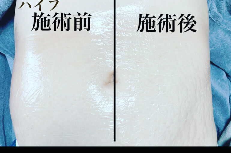 E83B4A77-5D45-474B-B084-7ABE89C3A8B0